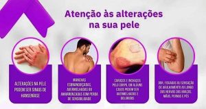 HANSENÍASE: SECRETARIA DE SAÚDE DE CASTILHO PROMOVE CAMPANHA