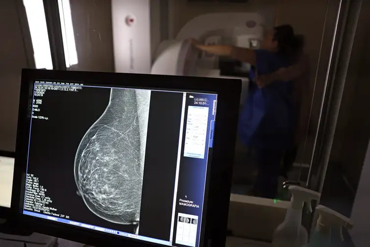 Médicos lançam guia para evitar recusa de mamografia digital por planos de saúde