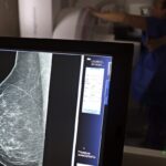 Médicos lançam guia para evitar recusa de mamografia digital por planos de saúde