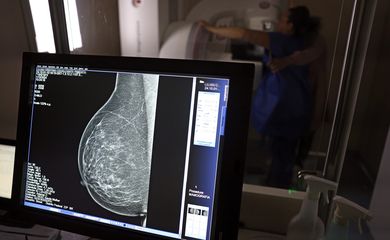 Brasília (DF), 01/10/2024 - Teste de mamografia realizado na Campanha Outubro Rosa: Sesc-DF, que oferece exames e consultas gratuitas às mulheres. Foto: José Cruz/Agência Brasil