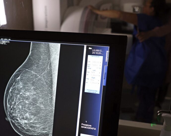 Médicos lançam guia para evitar recusa de mamografia digital por planos de saúde