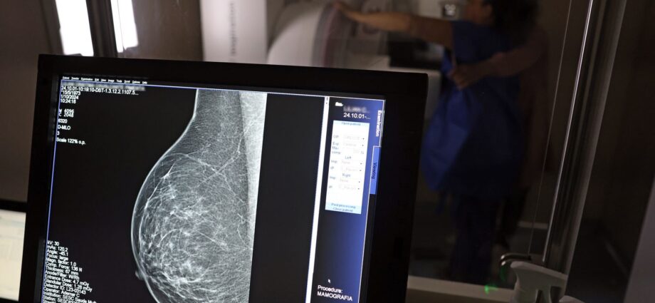 Médicos lançam guia para evitar recusa de mamografia digital por planos de saúde