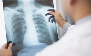 Médico analisa uma radiografia. Os sintomas do paciente, identificados na radiografia, e os resultados são relatados online por meio de videoconferência. Foto: Chanakon/AdobeStock